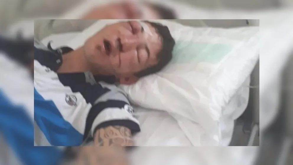 Horror: dos policías golpearon brutalmente a un jovencito a la salida del boliche