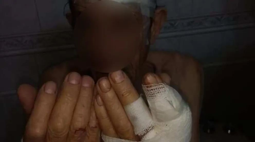 Cobarde: torturó a un abuelito para robarle