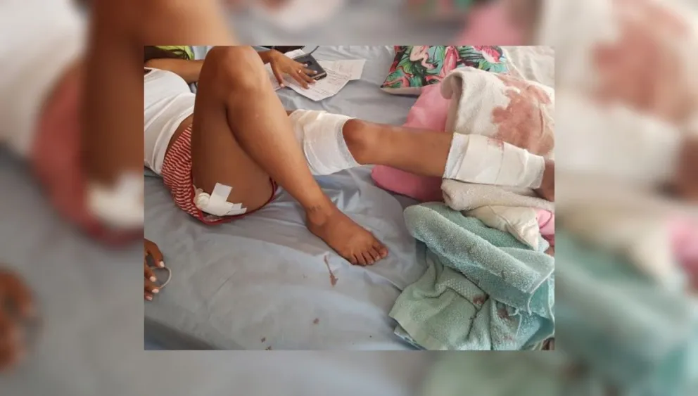 Salvajes: dos pitbull atacaron a una jovencita
