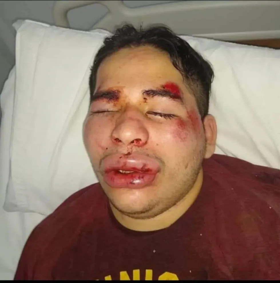 Atacaron y desfiguraron la cara de un rubgier: “Nicolás está vivo de milagro"
