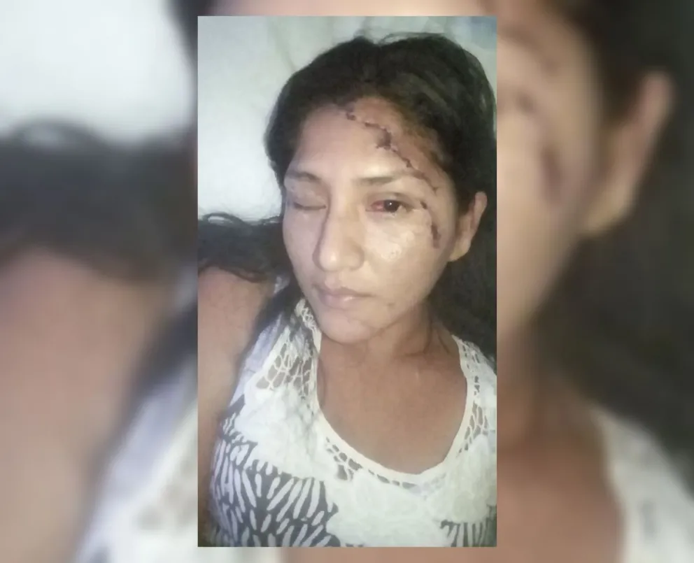 Desesperación: una salteña que fue brutalmente agredida necesita ayuda y no le dan respuestas