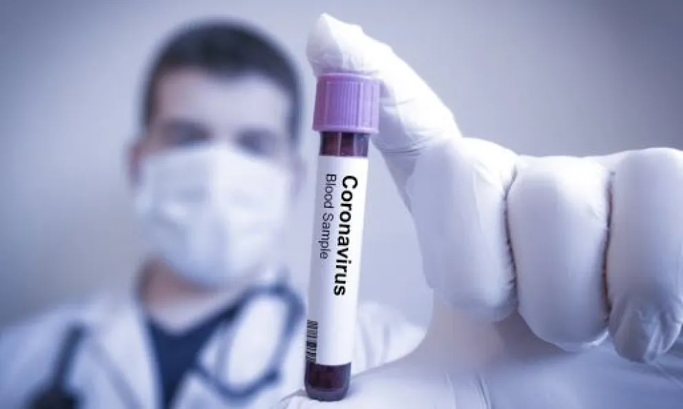 CORONAVIRUS 