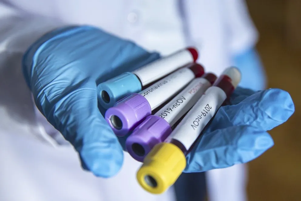 En las últimas 24 horas, creció el número de infectados por coronavirus en Argentina