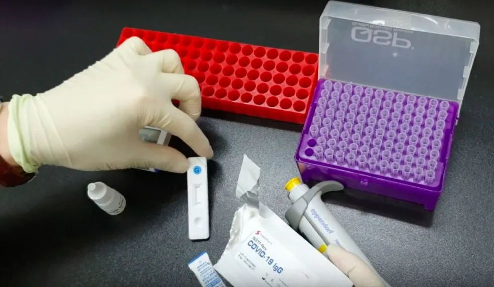 Coronavirus en Argentina: se harán testeos rápidos para analizar la circulación del virus