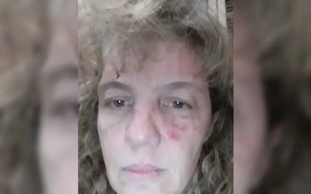 ¡Tremendo! Enfermera fue brutalmente agredida por un vecino: mirá lo que le hizo el agresor