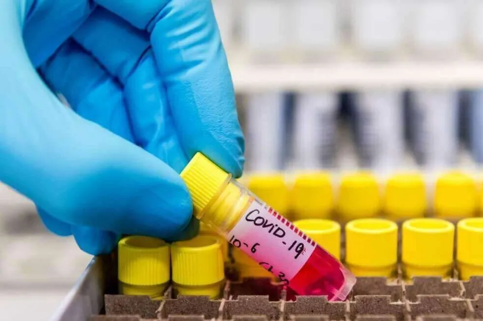 Confirmado: Argentina recibirá 25 millones de dosis de la vacuna contra el coronavirus
