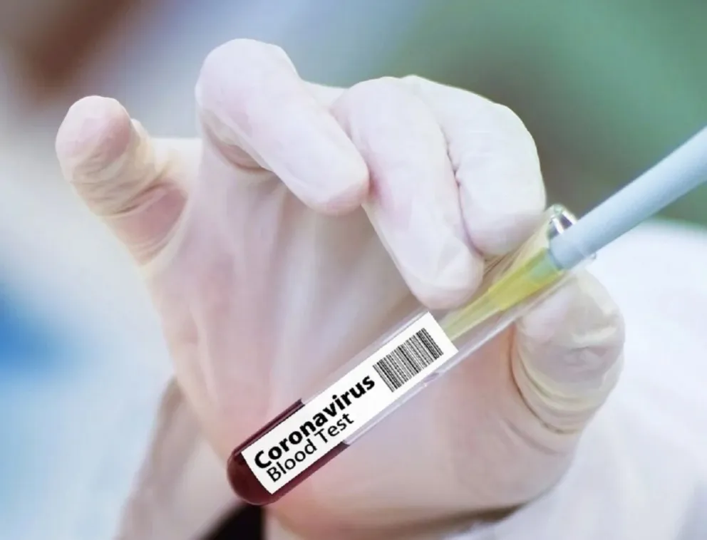 Coronavirus. Fuente: Pixabay
