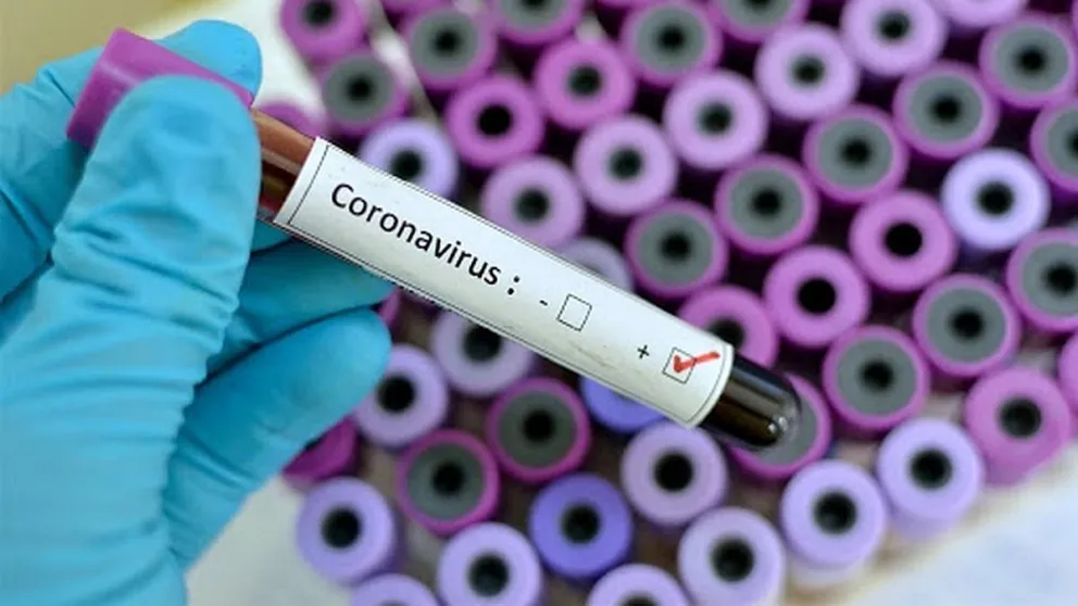 Coronavirus