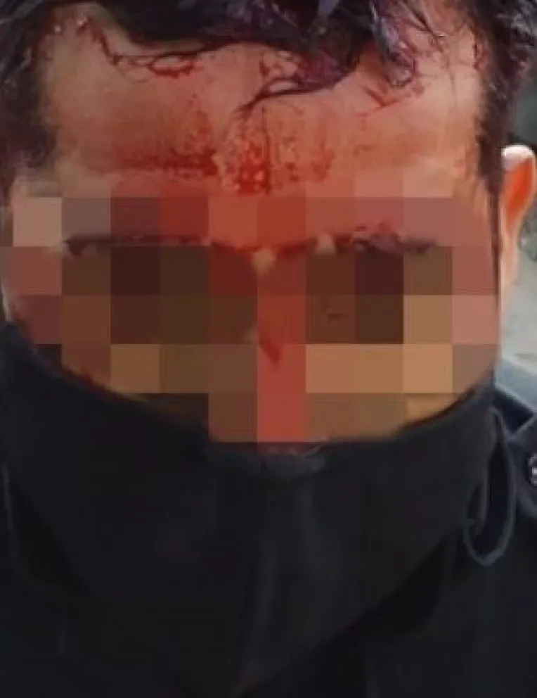 policia herido