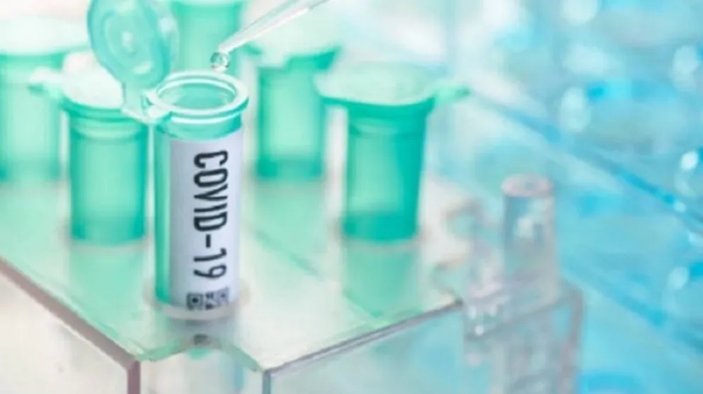 [Atención] Coronavirus en Salta: tiene 88 nuevos casos en las últimas 24 horas