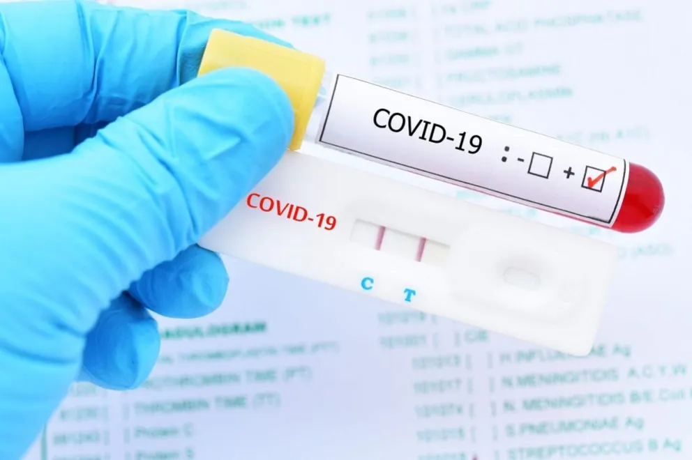 La clave para saber si tuviste Covid-19 y no te diste cuenta 