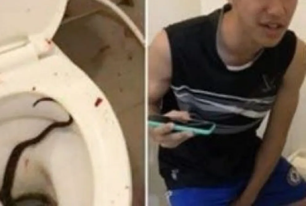 El peor miedo: se sentó en el inodoro y nunca imaginó que una serpiente iba a morderle la "sin hueso"