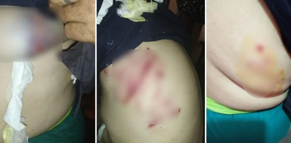 Abuelita ataque de perros