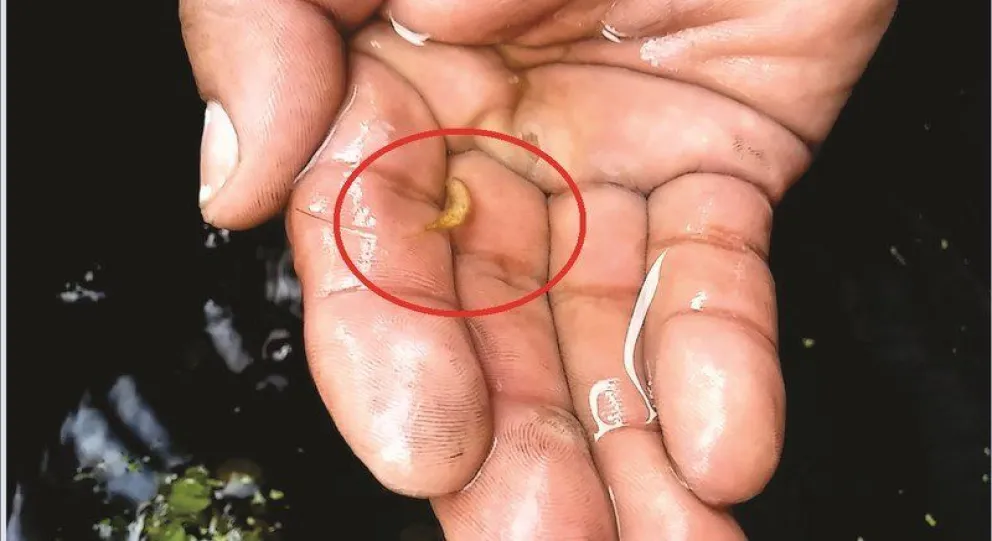 Gusanos en el agua potable y la vista gorda de Aguas del Norte