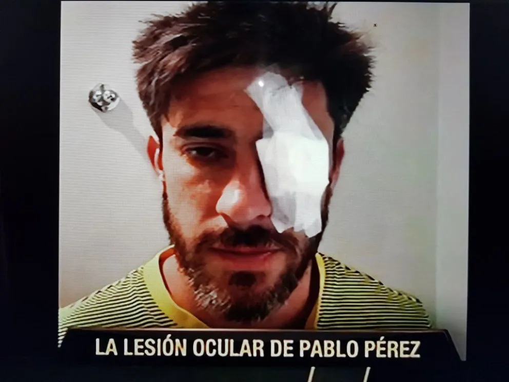Así quedaron los jugadores Xeneizes luego del feroz ataque