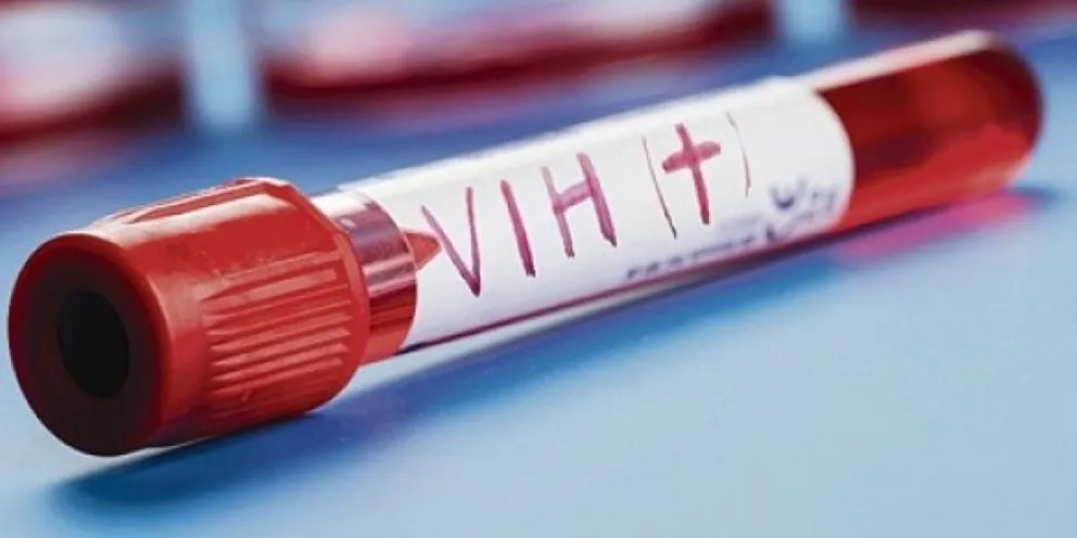 Alarmante cifra sobre el VIH