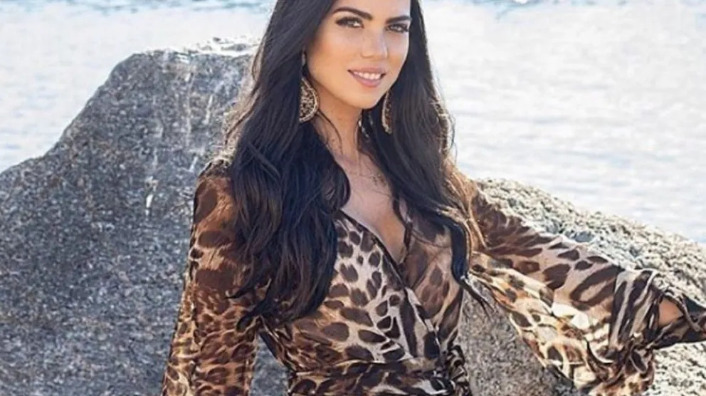 Conocé la historia de la candidata a Miss Universo que le quemaron la cara