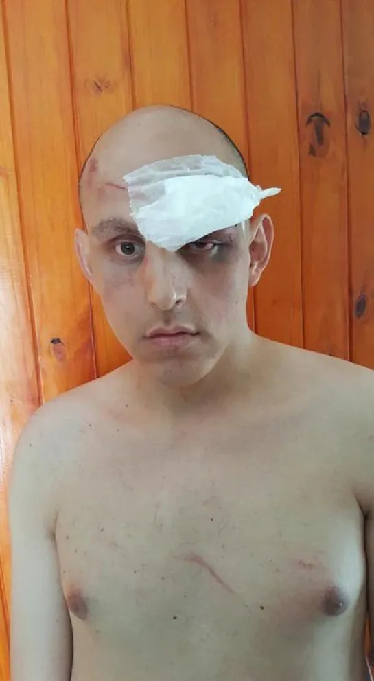 Lo molieron a golpes por ser gay