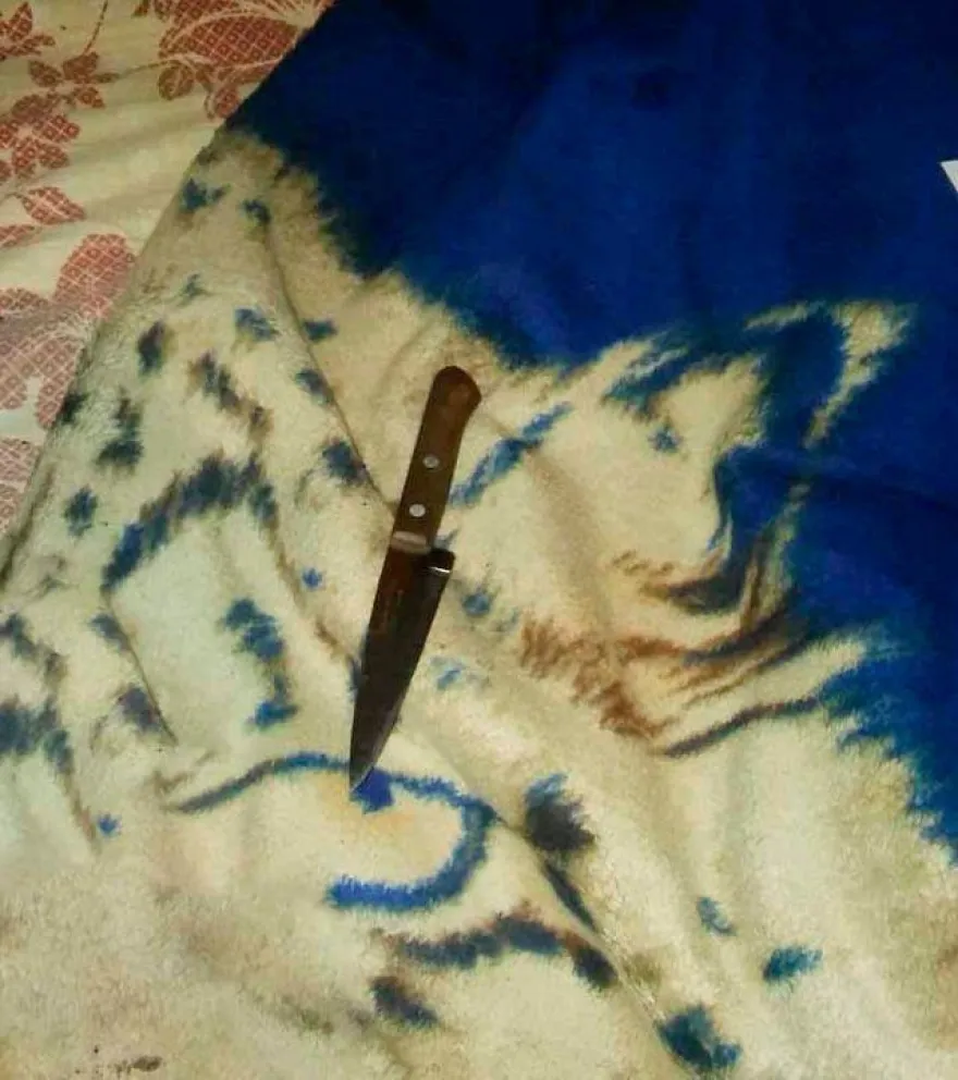 Lo hirieron con un arma blanca. ¿Cómo resultó?
