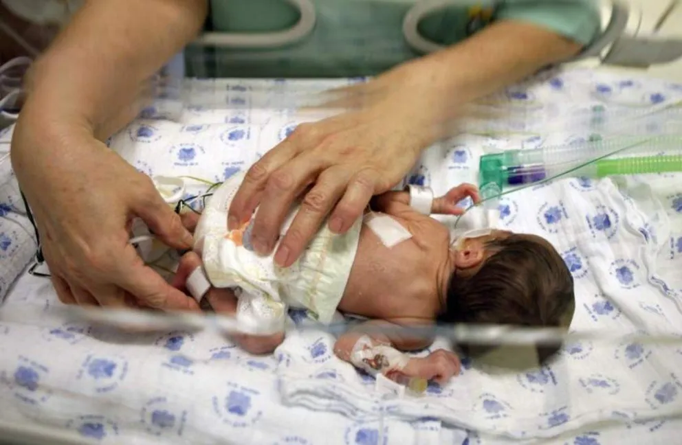 Milagroso récord: nació la bebita más pequeña del mundo