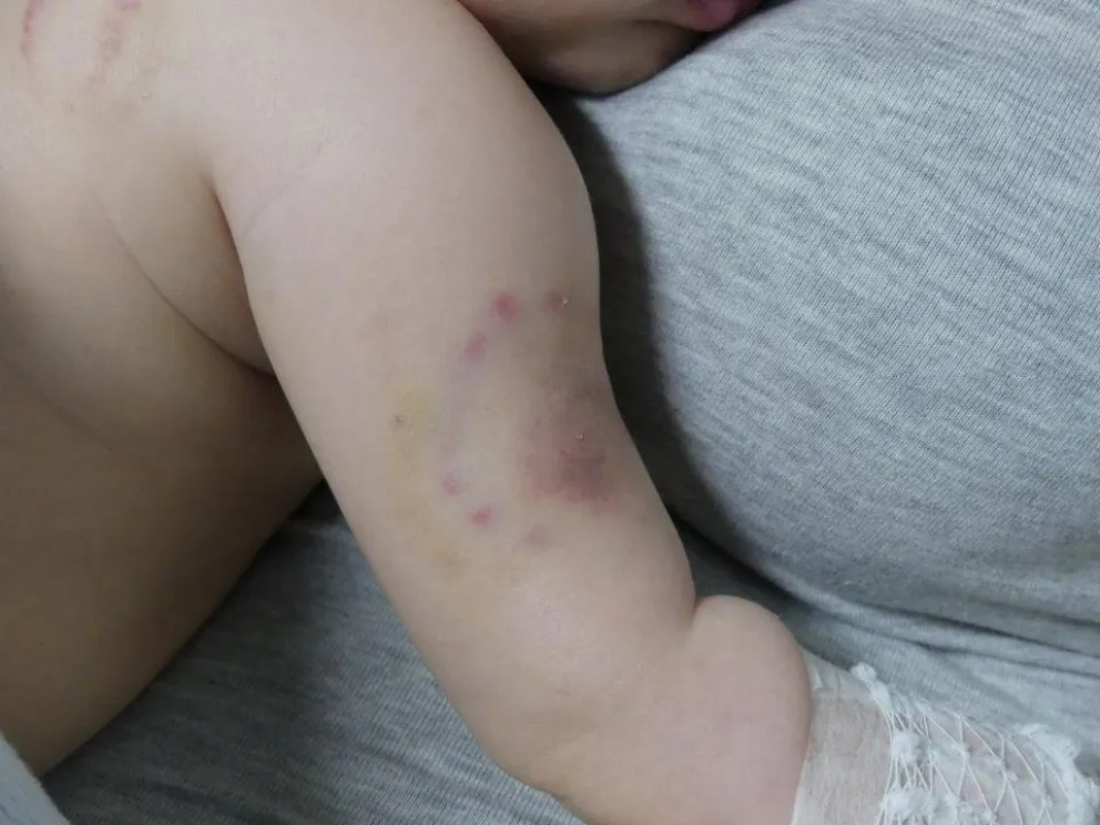 VIDEO. Beba de cuatro meses fue maltratada en una guardería