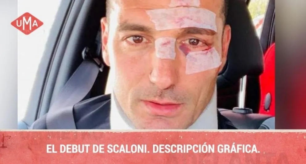Tras la derrota de la Selección Argentina, estallaron los memes