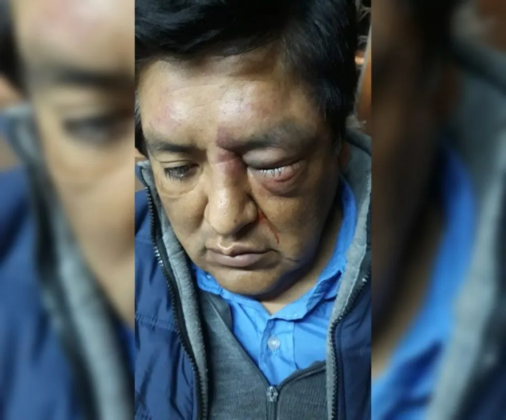 Violencia al palo: un chofer de SAETA fue golpeado ferozmente