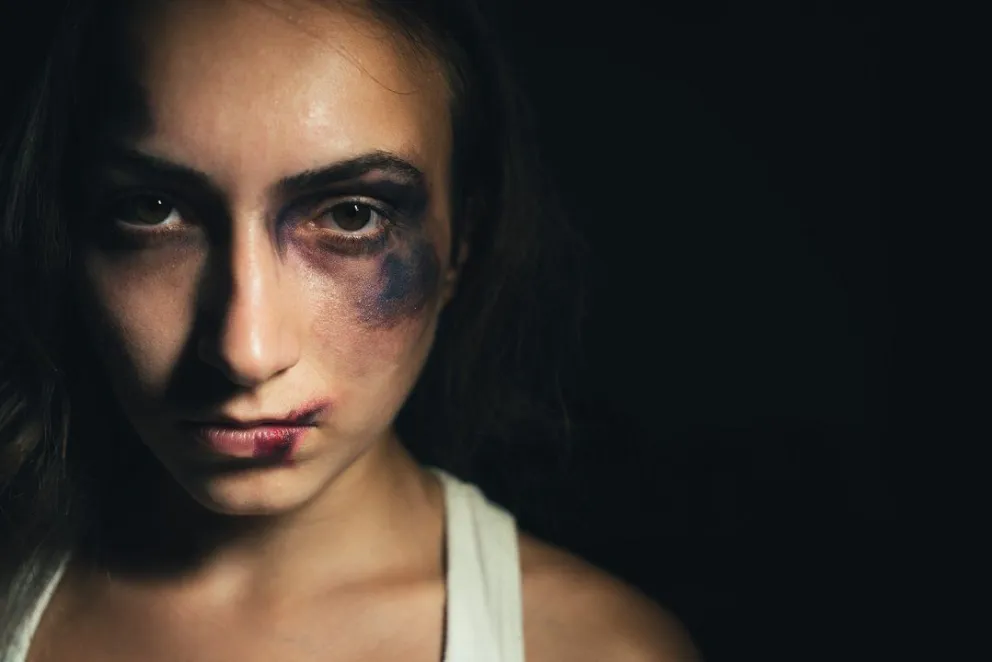 Mujer trans fue brutalmente golpeada por su tío