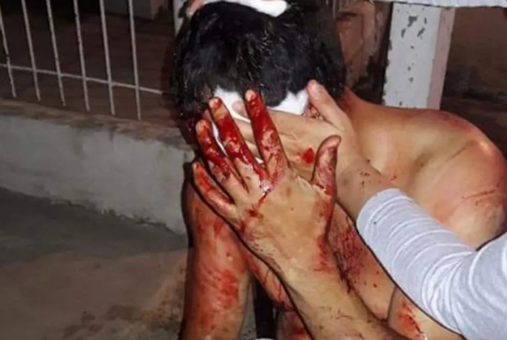 Injusticia, discriminación y tortura a joven wichi