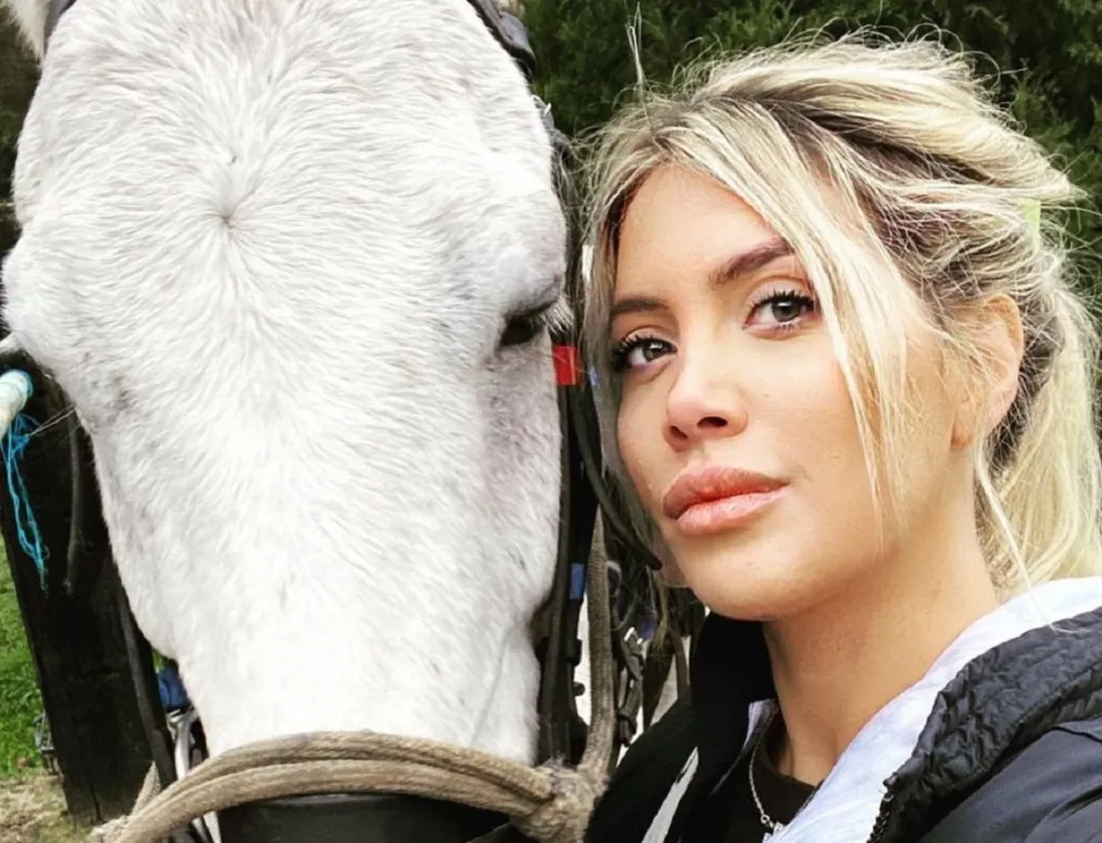 Se conocieron las cirugías que Wanda Nara se ha realizado a lo largo de su vida