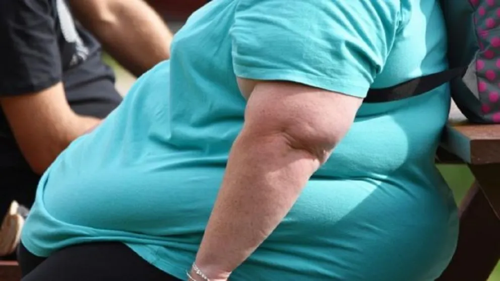 Persona obesa 