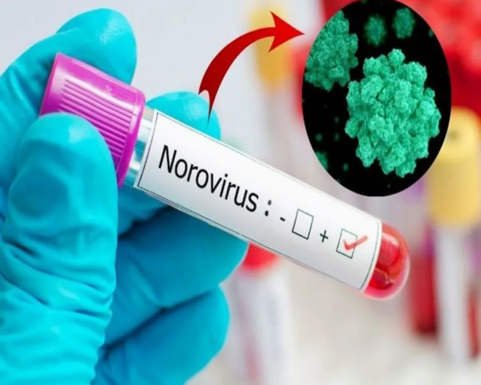 Alarmante: un nuevo brote de Norovirus preocupa a China