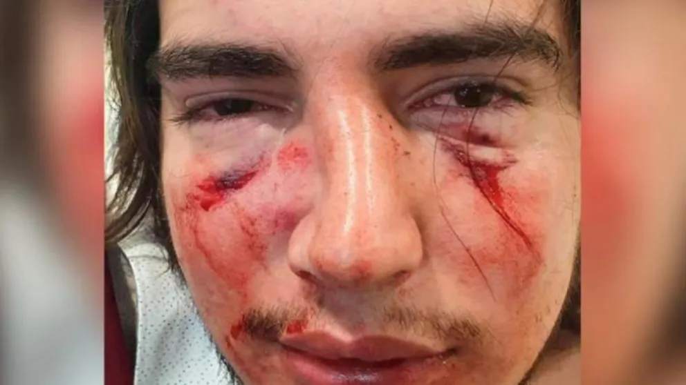 Quiénes son los dos rugbiers imputados por la justicia tras darle una brutal paliza a un jovencito