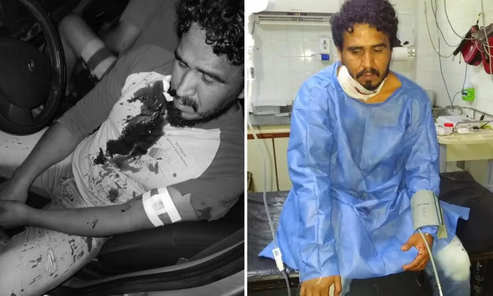"Tantas veces me mataron": así quedó el periodista salteño que fue apuñalado mientras hacía un vivo