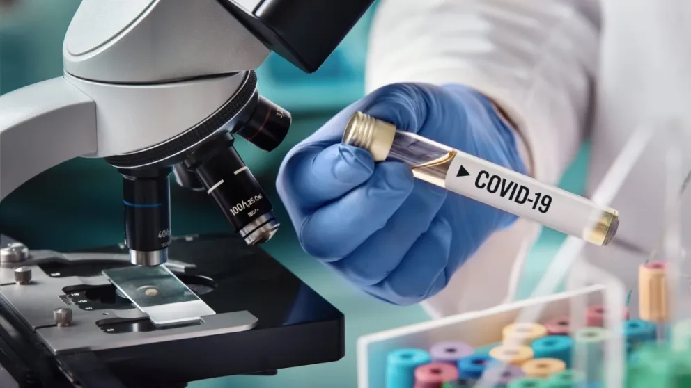 Laboratorio Coronavirus