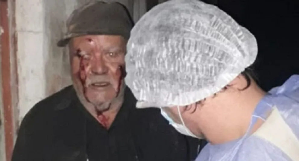 Niños de 10 y 13 años desfiguraron a golpes a un anciano y le prendieron fuego la casa