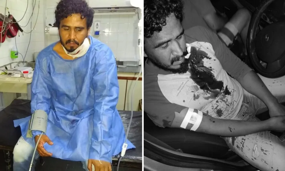 Será justicia: detienen e imputan al delincuente que apuñaló al periodista salteño mientras hacía un vivo