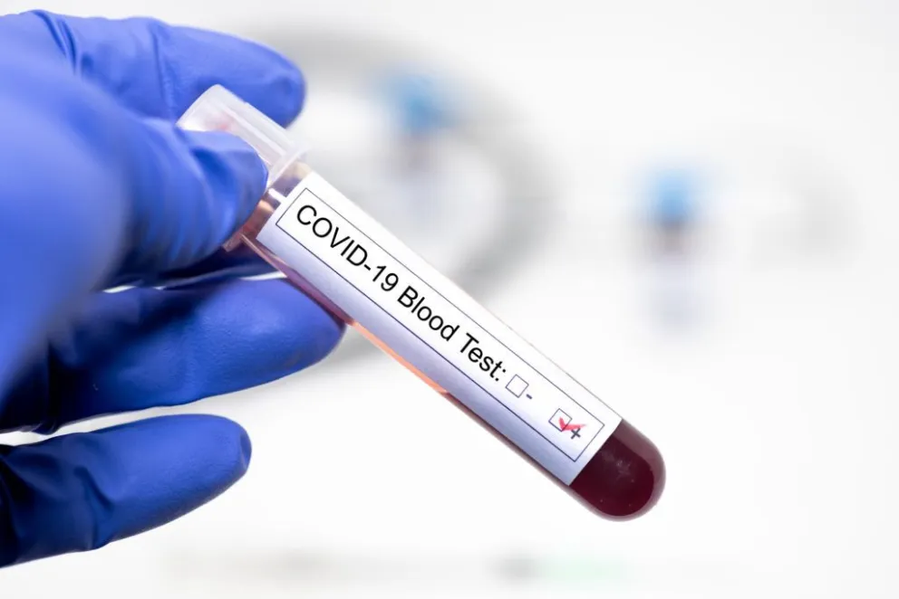 México: Un hombre se suicidó creyendo que tenía coronavirus