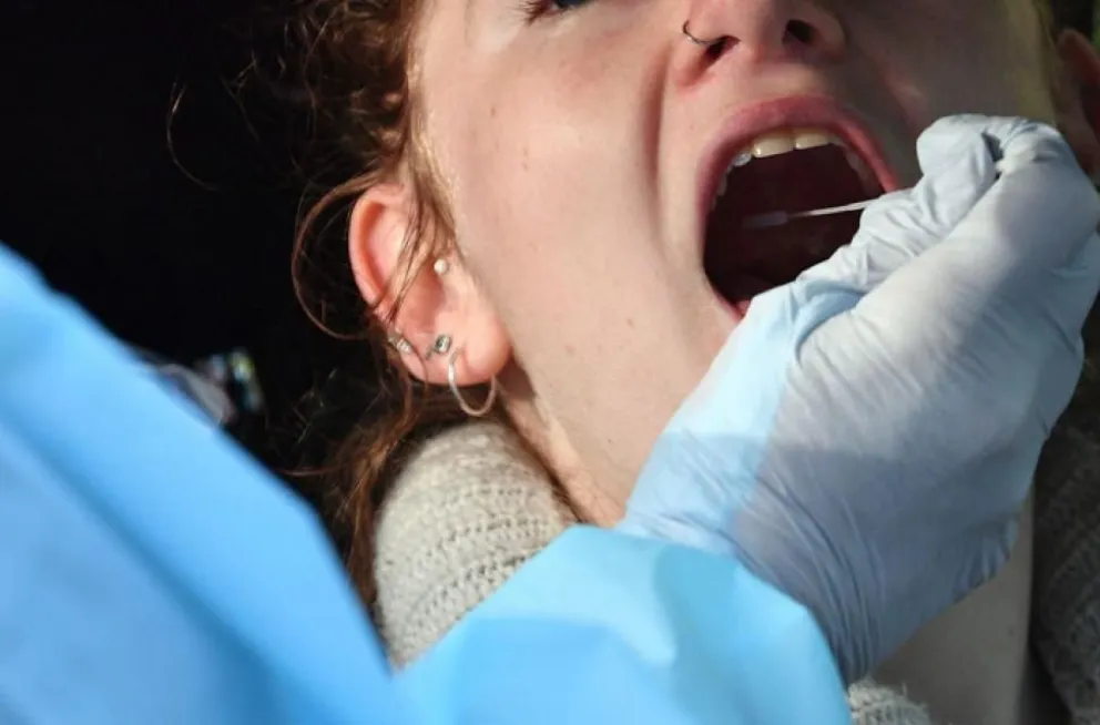 “Lengua Covid” el nuevo síntoma del coronavirus