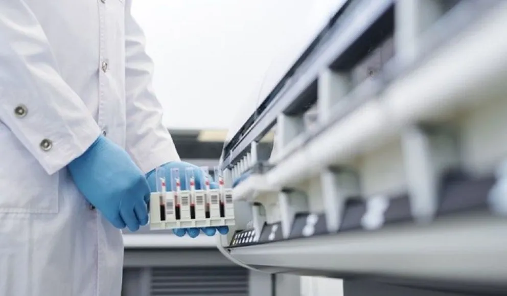 Coronavirus en Salta: dos personas murieron y se confirmaron otros 102 nuevos casos