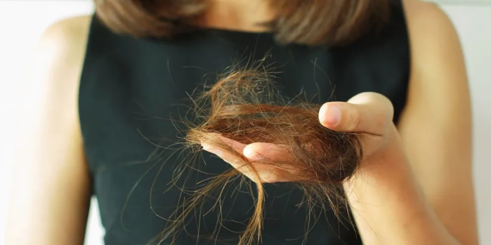 Aseguran que la caída exagerada del cabello es uno de los efectos secundarios del Covid-19