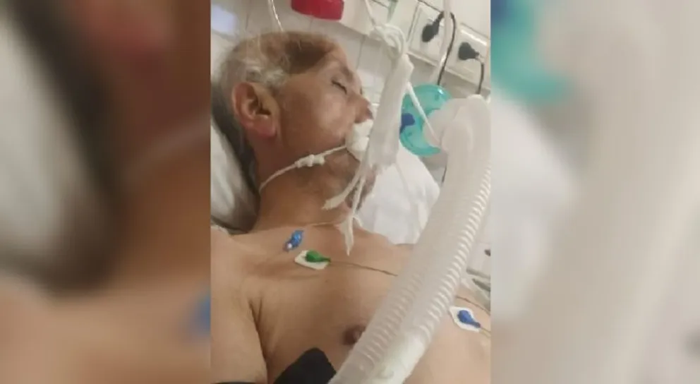 Le hundieron el cráneo: así quedó un salteño que fue atacado por el novio de su exmujer y todavía no se recupera
