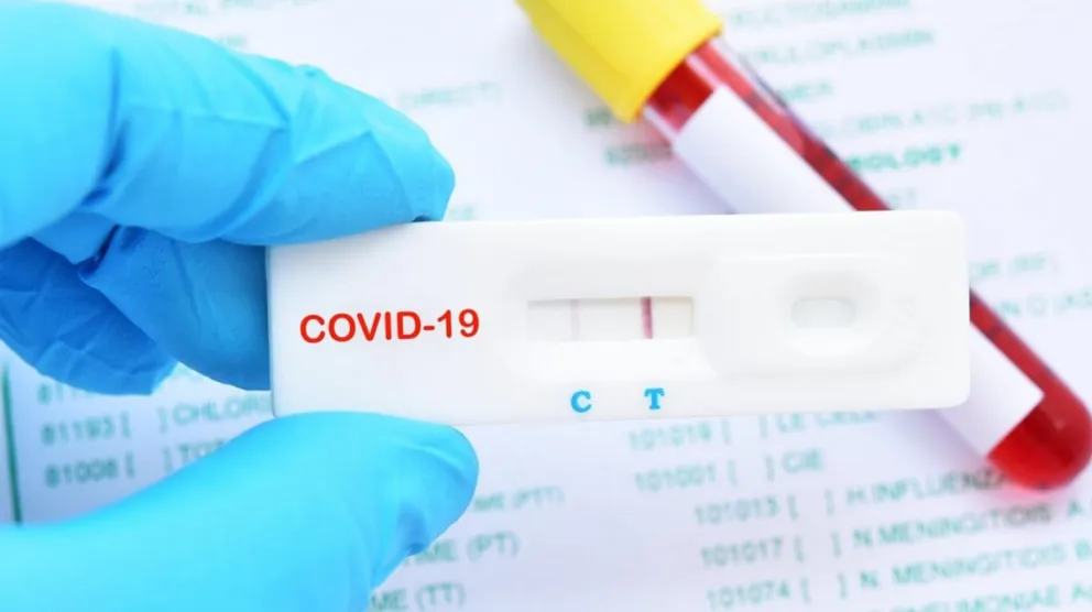 Coronavirus en Argentina: hubo 83 muertes y se confirmaron 10.384 casos en las últimas 24 horas
