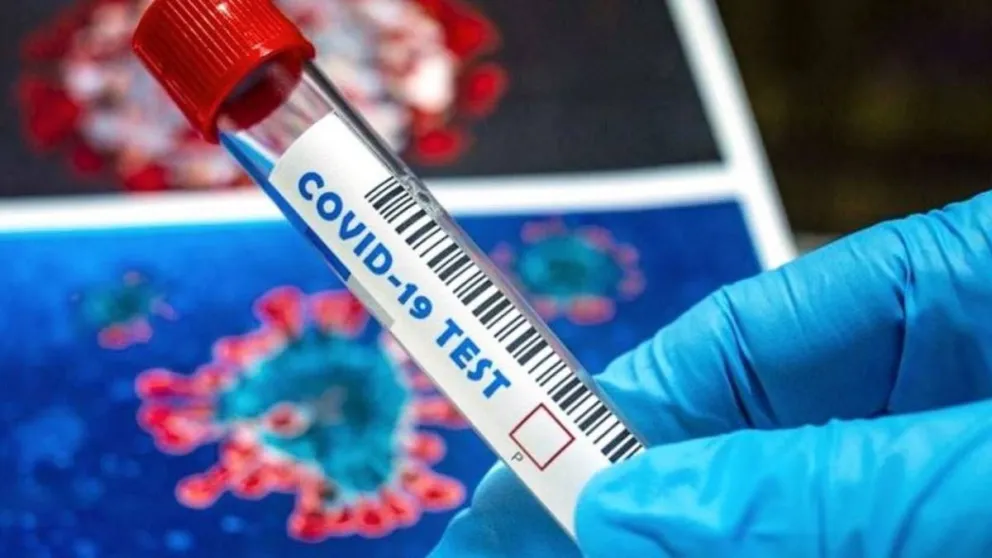Reporte de coronavirus en Salta: 30 de mayo 