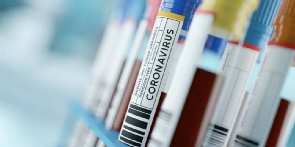 Coronavirus en Salta: médico mostró la impactante diferencia de contagios entre 2020 y 2021